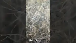 Mold from Banana Under Microscope. #shorts #nature  #microscope