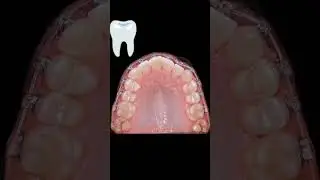 #dentist #smiledentist #satisfying #dentalwork #filling #doctor #dentallab #smile