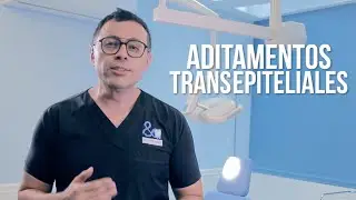 Aditamentos Transepiteliales. &iquest;Qu&eacute; son y para qu&eacute; sirven?