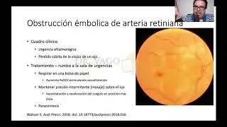 La oclusi&oacute;n arteria central de la retina vs. la Sierra de Guerrero - Dr. Vago ENARM 2019