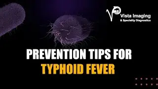 Typhoid Fever Symptoms & Preventions | Vista Imaging & Speciality Diagnostics | CT/MRI/Ultrasound