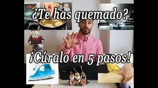 5 PASOS si te has QUEMADO con ACEITE//AGUA HIRVIENDO//LA PLANCHA//CERA//ETC