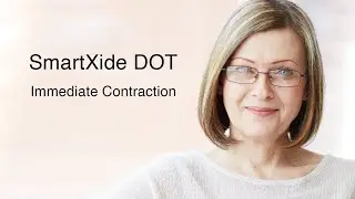Deka Dot Immediate Contraction