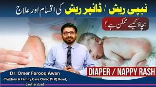 Diaper Rash Types and Prevention | نیپی  ریش کی اقسام اور علاج