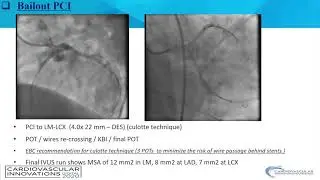 Gergis_Что-то, о чем стоит беспокоиться в левой основной коронарной артерии PCI_Coronary