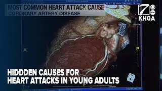 Hidden causes for younger adult heart attacks