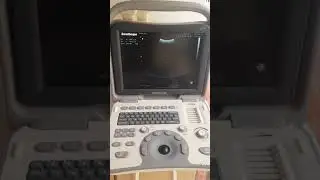 Sonoscape A5  Vid2