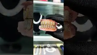 DM us For Custom Grillz #icecartel #customgrillz #diamond