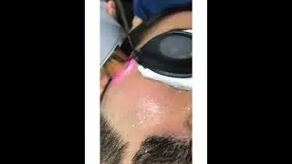 Twachaa Skin Care And Laser Centre Navsari @ajay modi