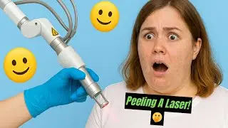 4 TIPOS DE PEELING A LASER: QUAL &Eacute; O IDEAL PARA SUA PELE? 💥
