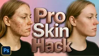 Remove Acne in Photoshop &ndash; Professional Hard Mode Tutorial 🔥 (Step-by-Step)