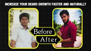 HOW TO GROW A BEARD FASTER NATURALLY | Grooming Tips | RABIRAJ'S LIFESTYLE