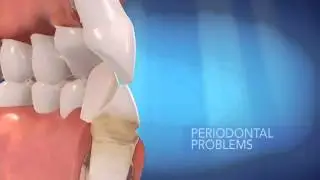 Encino Invisalign Cosmetic Dentist Mirror Cosmetic Dentistry 818-906-3838