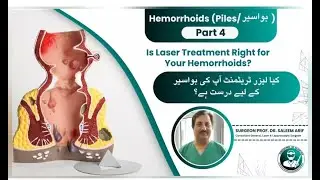𝐇𝐞𝐦𝐨𝐫𝐫𝐡𝐨𝐢𝐝𝐬 (𝐏𝐢𝐥𝐞𝐬) 𝐏𝐚𝐫𝐭 𝟒 | 𝐈𝐬 𝐋𝐚𝐬𝐞𝐫 𝐓𝐫𝐞𝐚𝐭𝐦𝐞𝐧𝐭 𝐑𝐢𝐠𝐡𝐭 𝐟𝐨𝐫 𝐘𝐨𝐮𝐫 𝐇𝐞𝐦𝐨𝐫𝐫𝐡𝐨𝐢𝐝𝐬?