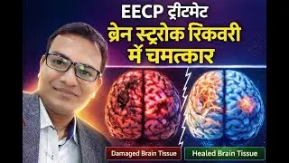 EECP Therapy For Stroke Recovery | Brain Stroke Recovery | NexIn Health | EECP Therapy Delhi - NCR