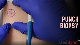 4. Пункционная биопсия | Я использую этот метод, чтобы избежать плохих результатов