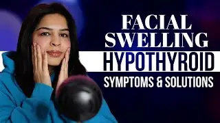 Fix Thyroid Symptoms | Facial Swelling