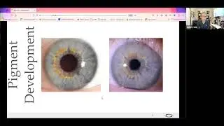 Iris Pigments - what they mean