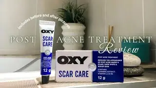 Treating my post acne marks |OXY Scar Care review| sensitive acne Prone skin | affordable Skincare