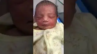 Newborn Baby in NICU with Gentle Red Face &ndash; Normal Newborn Rash Care #firstborn