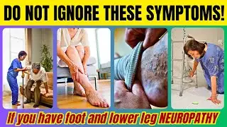 5 WARNING SIGNS for Lower Leg and Foot Tingling, Numbness, Pins & Needles Sensation| Doc Cherry