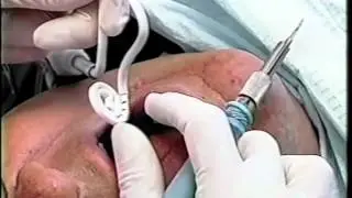 Nancy Miller Video USI 25 MPLC   1995