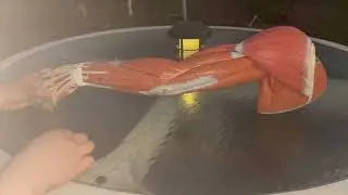 Мышцы верхних конечностей