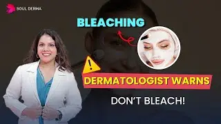 Face Bleaching: Safe or Harmful? Dermatologist Explains Risks & Better Alternatives