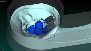 Vortex turbine simulation using Particleworks