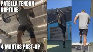 4 Months Post-Op Patella Tendon Rupture: Building Strength and Functionality