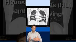 CT: Hounsfield Units & Windowing