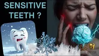 Sensitive teeth EXPLAINED! | Dentist Explains why cold hurts? ❄️ #teethsensitivity #dentaltips