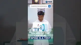 Treating Cervical Spondylosis