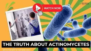 Worried About Actinomycetes in Your Home? Here&rsquo;s the TRUTH!