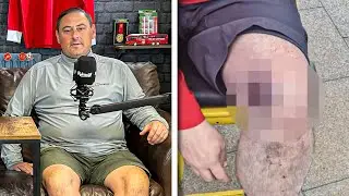 'IT'S BEEN TOUGH' - Danny Smith: Liverpool Fan Who Suffered Horrific Hammer Attack in Paris!