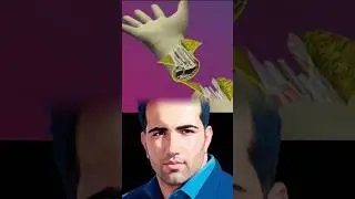Hand Transplantation #Handtransplantation #handtreatment #HandRecovery #medical #viralshort