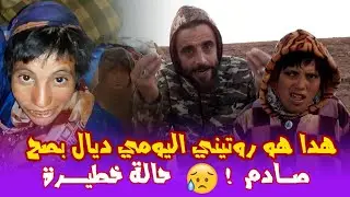 صادم مع السوردو...حالة خطيرة ومقصية من جميع الحقوق ..