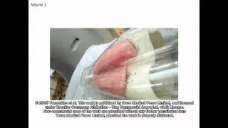 Continuous airway measurement on dynamic ventilation CT - Supplementary Video S1