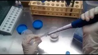sperm wash for iui