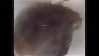 scalp ritual