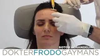 Botox behandeling frons voorhoofd en kraaienpootjes