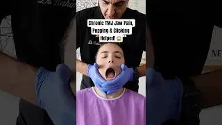 Chronic TMJ Jaw Pain, Popping & Clicking Helped!@drrahim #shorts #chiropractic