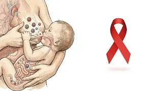 VIH/Sida y lactancia materna - Dr. José Garibaldi Soto