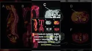 Revolutionizing Healthcare: The Transformative Power of AI in Medicine