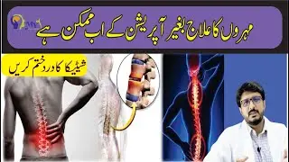 Disc problem & Sciatica Treatment Without Surgery | backpain ll Slip Disc Complete Guide | Dr Mohsin