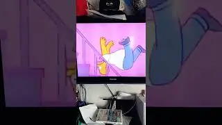 homer fell down the stairs broke his back.