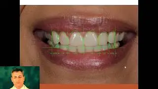 How does a cosmetic dentist design a porcelain veneer smile?