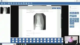 🔥 Radiovisiografo Toletek (Manejo del software parte 1) 🔥