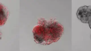 Cell Death in Intestinal Epithelial Organoids / Cell Reports, December 19, 2017 (Vol. 21, Issue 12)