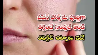 These Are Simple And Effective Tips To Reduce Open Pores Details! Open Pores - ఓపెన్ పోర్స్ ను పూర